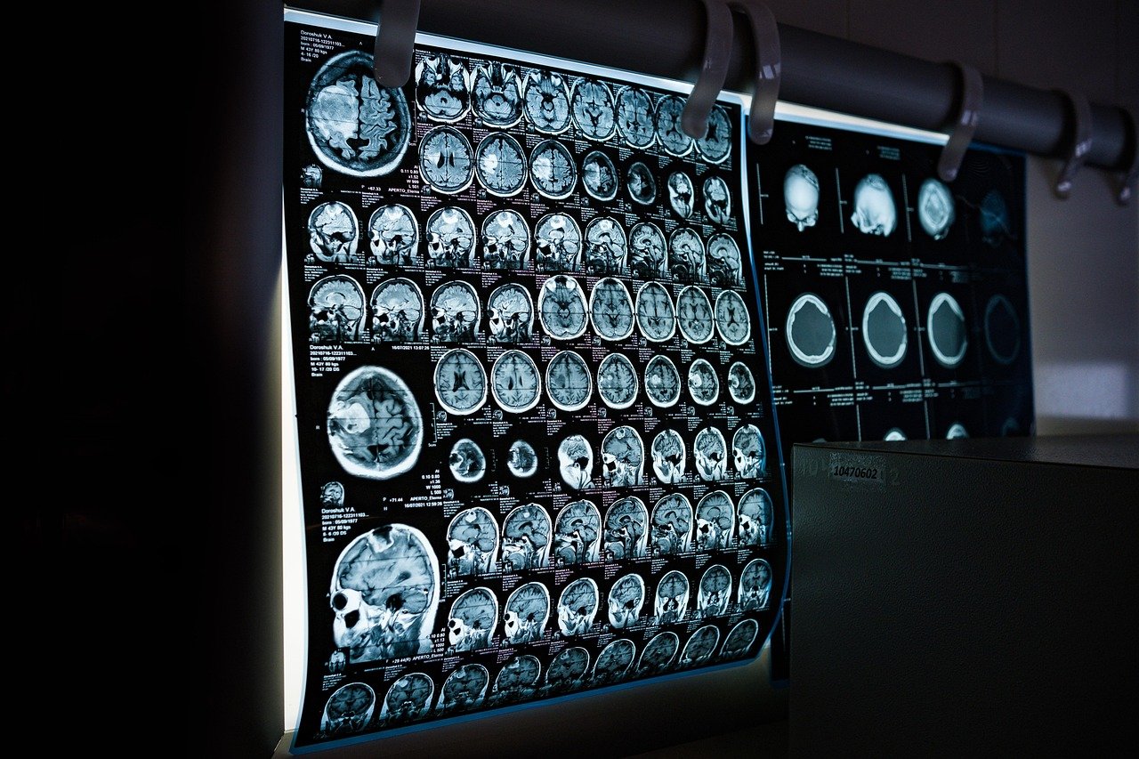 AI in Healthcare: Balancing Innovation and Ethics (image credits: pixabay)