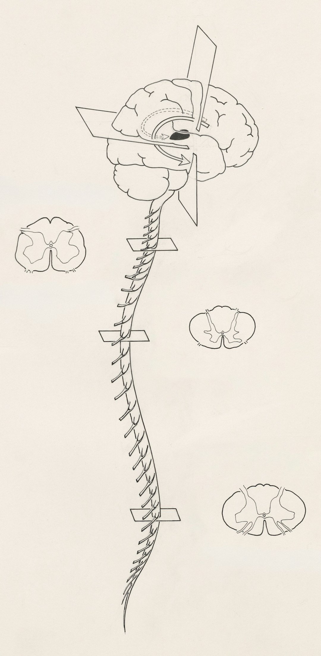 Restoring Movement Through the Spine: BCIs Beyond the Brain (Image Credits: Unsplash)