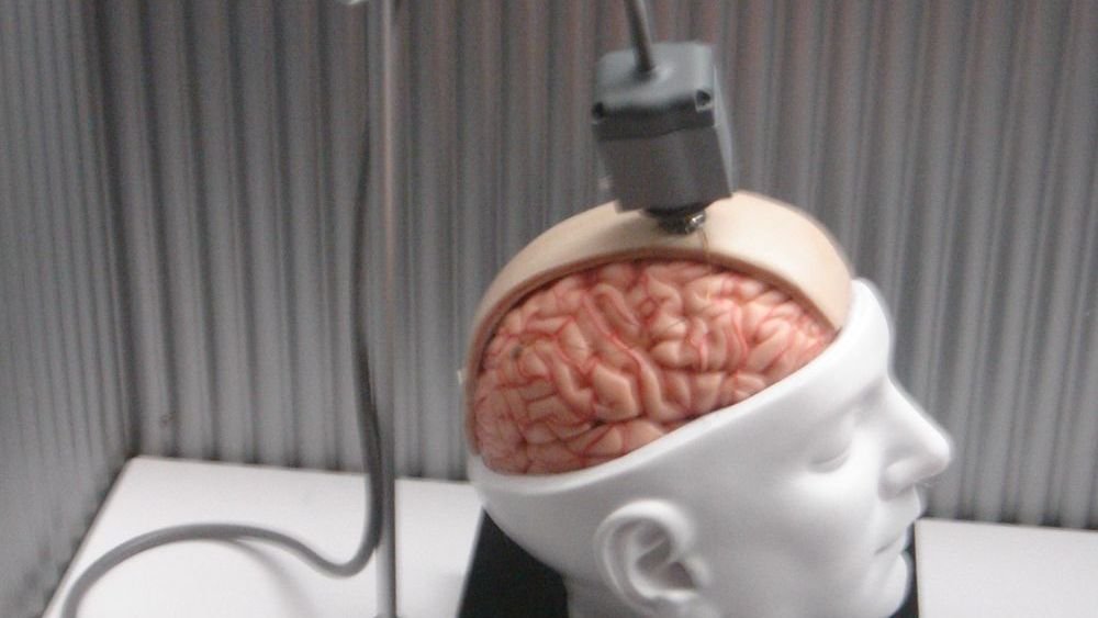 The "Neural Bridge": The Reality of Brain-Computer Interfaces in 2026