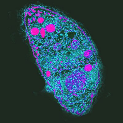 How Parasites Hijack the Nervous System: A Real-World Parallel (Toxoplasma gondii, CC BY-SA 2.0)