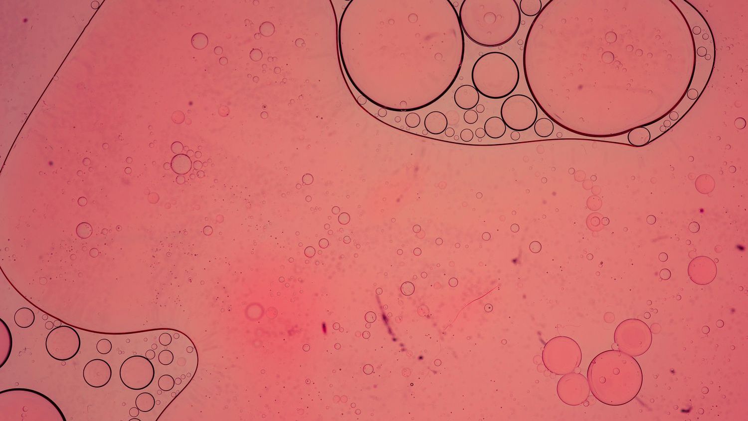 Early human embryonic cells may be vulnerable to SARS-CoV-2 infection
