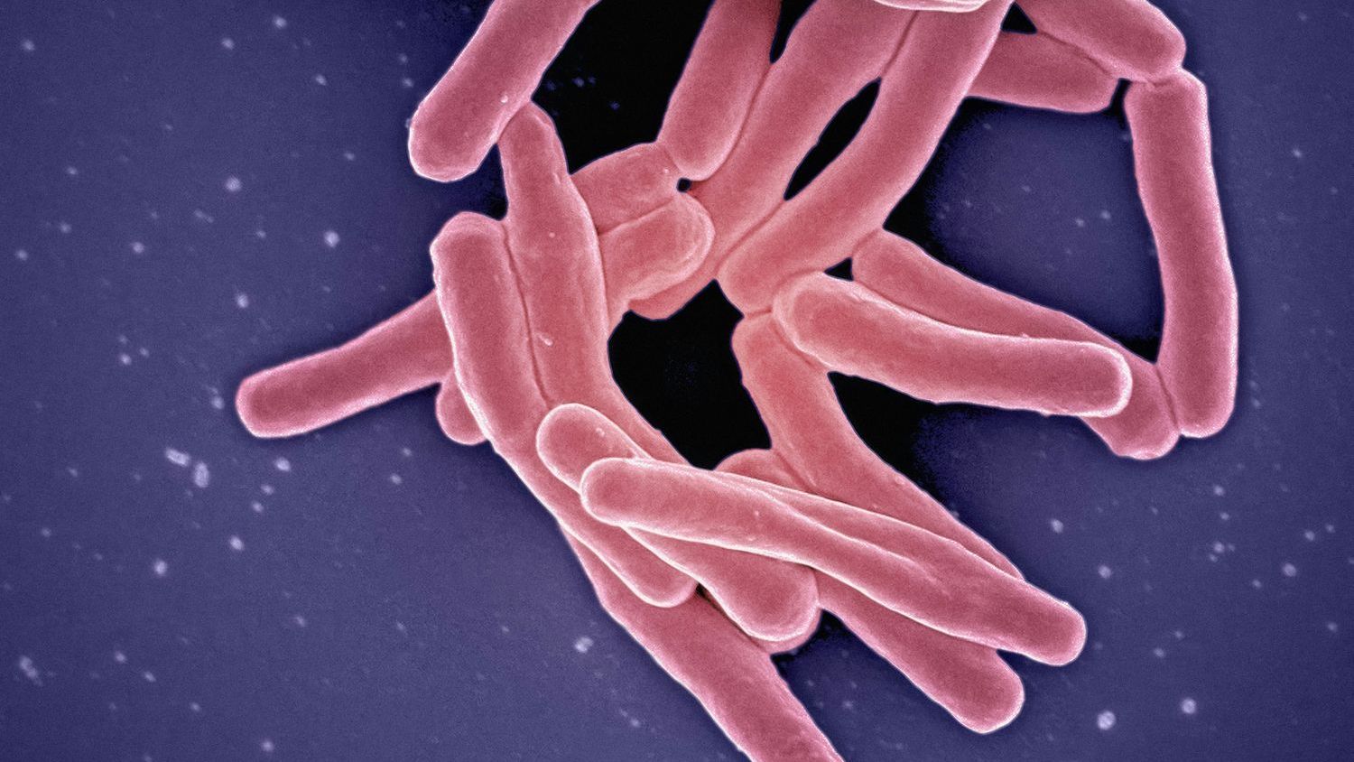 This Gut Factor Predicts How Strongly You React to Stress (M)