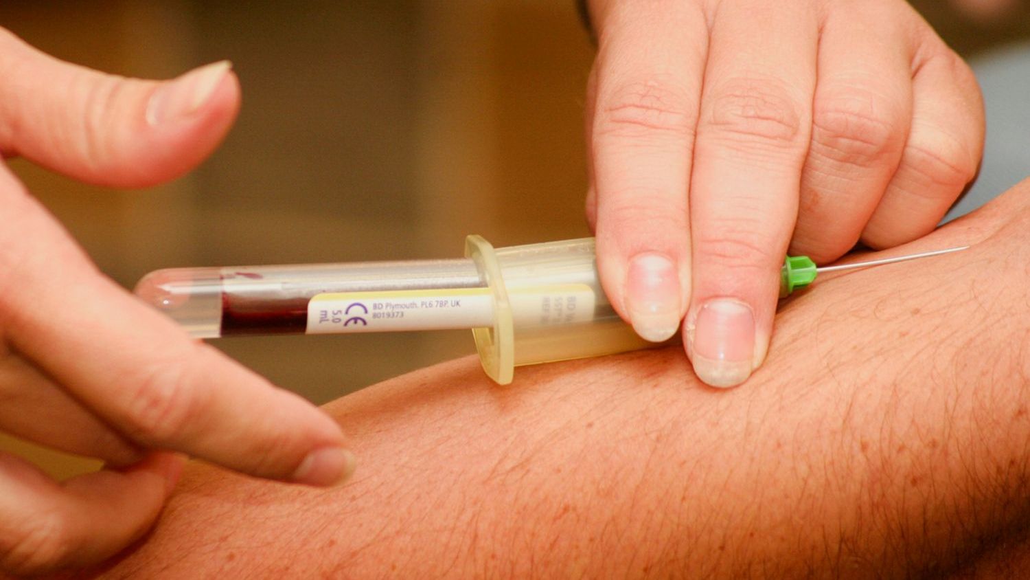 Blood-based DNA marker tracks arsenic exposure and may predict toxicity risk