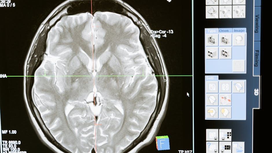 Lacunar strokes caused by widening of arteries in brain, study suggests