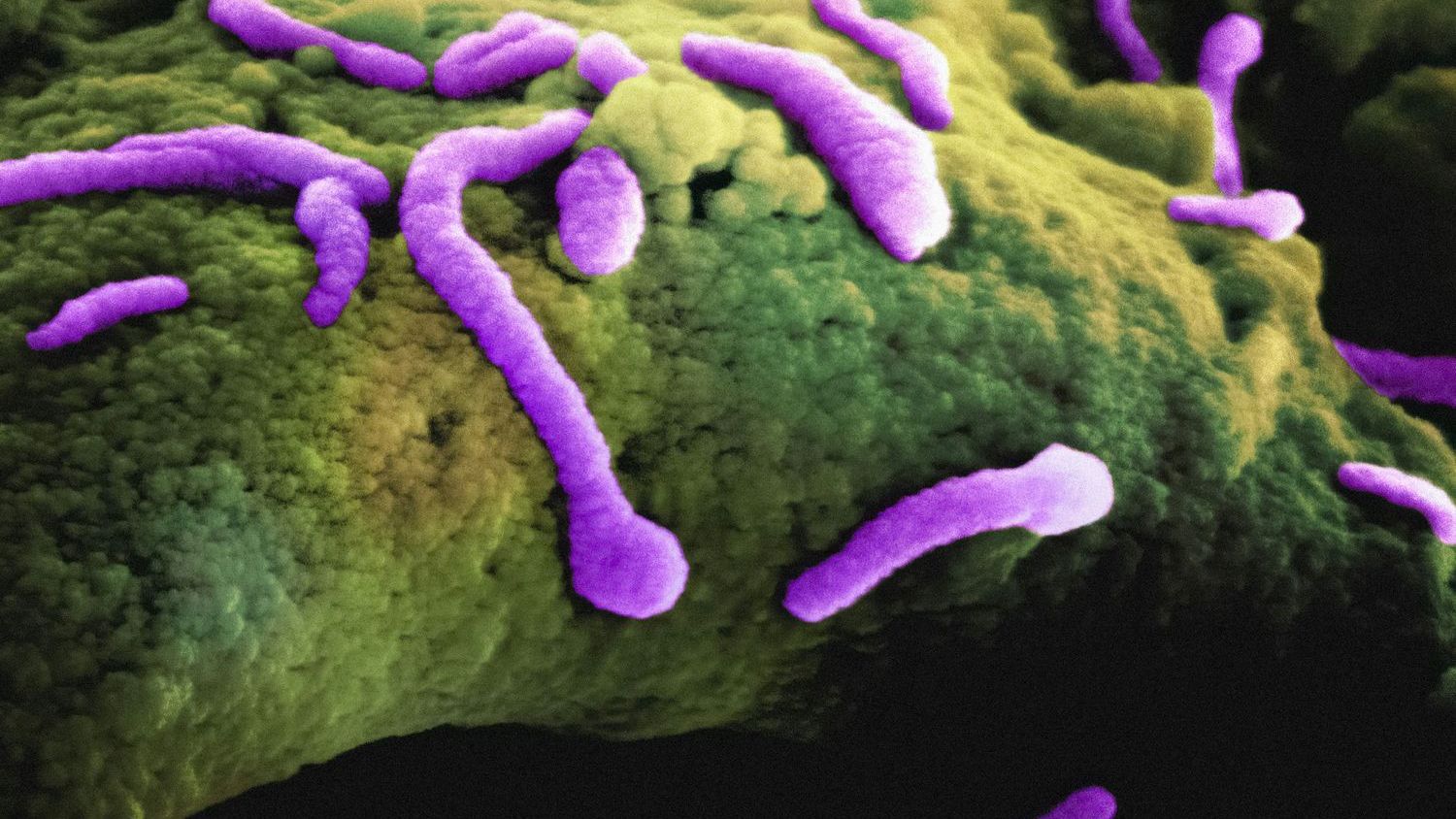 Scientists discover a new way to prevent gum disease without killing good bacteria