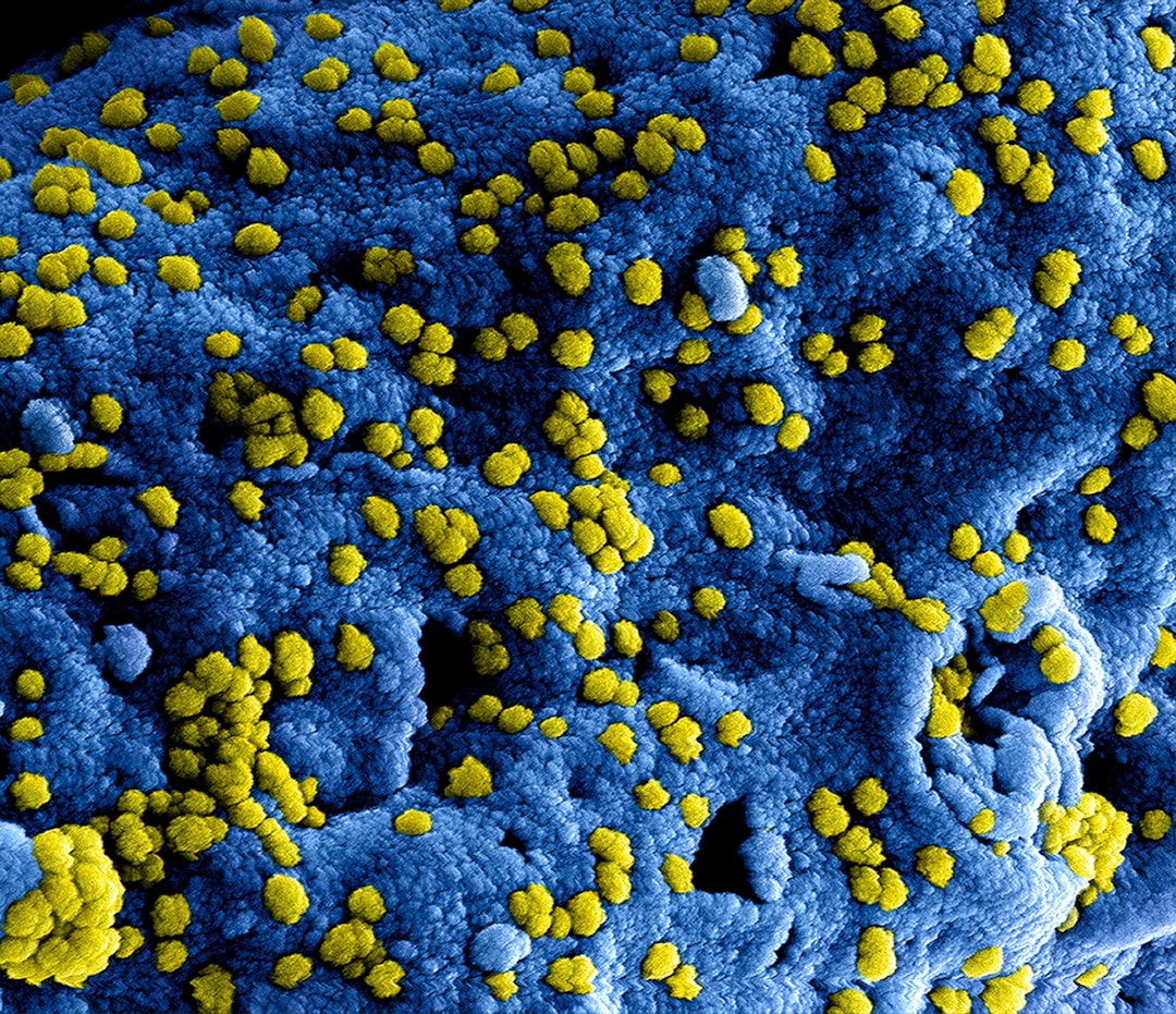 A City Unprepared: The Arrival of Yellow Fever (Image Credits: Unsplash)