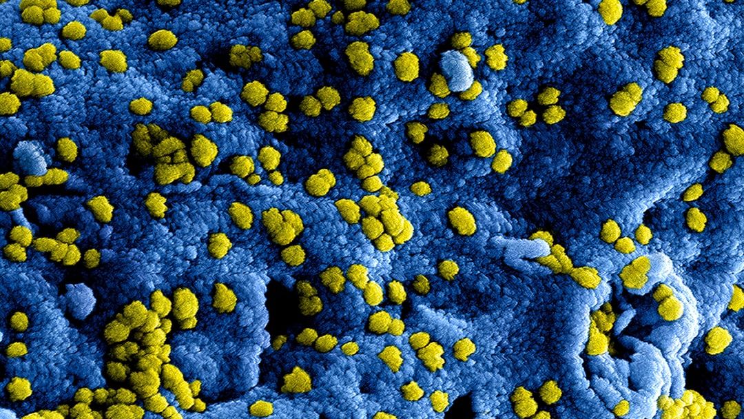 The "Yellow Fever" Cipher: How a 1793 Epidemic Accidentally Created the Modern US Healthcare System