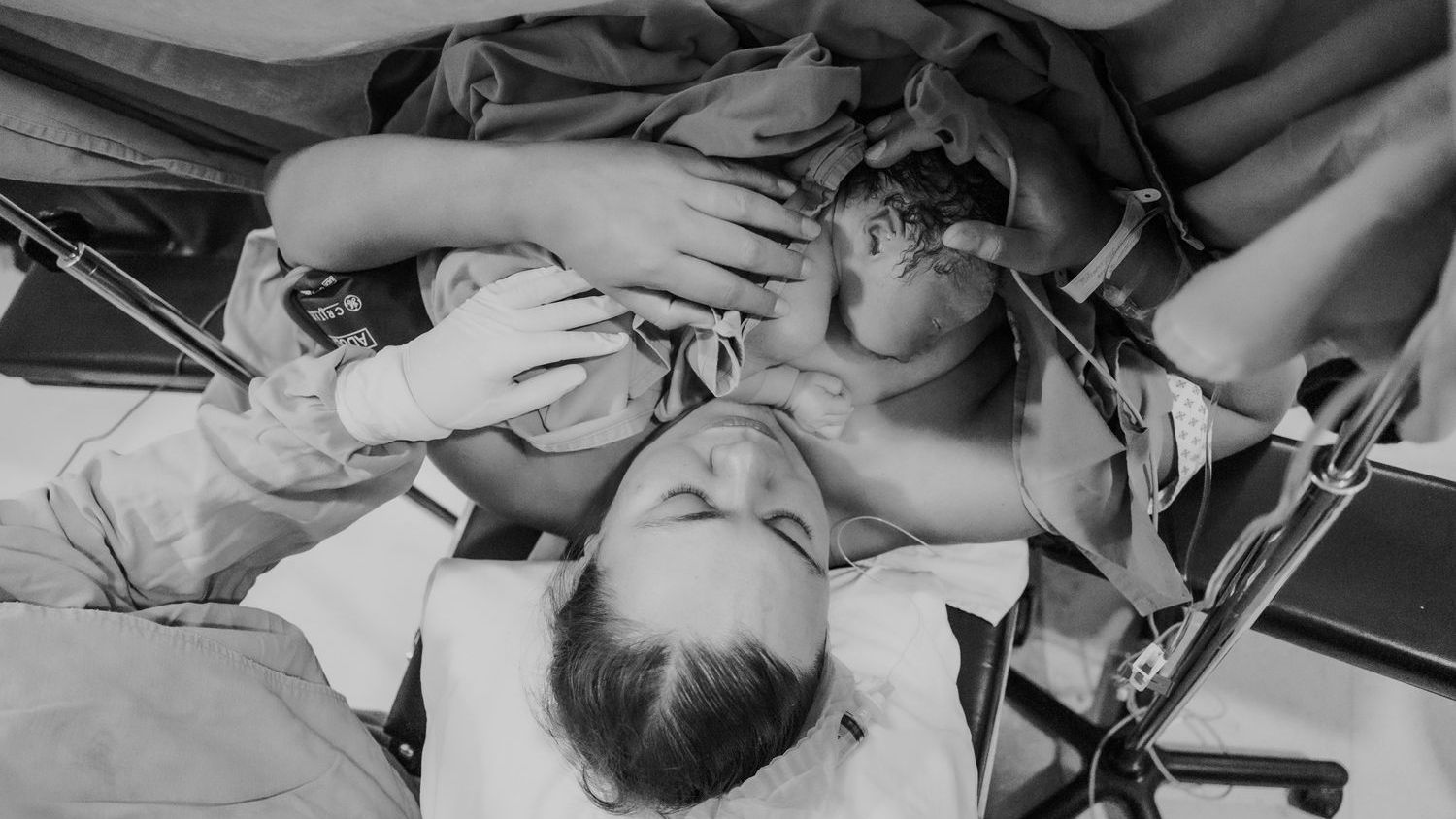 Diagnostic dilemma: An infant's brown eyes turned indigo after COVID antiviral treatment