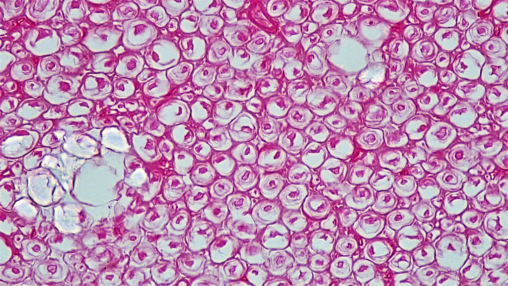 What Happens to Myelin When Your Diet Goes Wrong (Image Credits: Flickr)