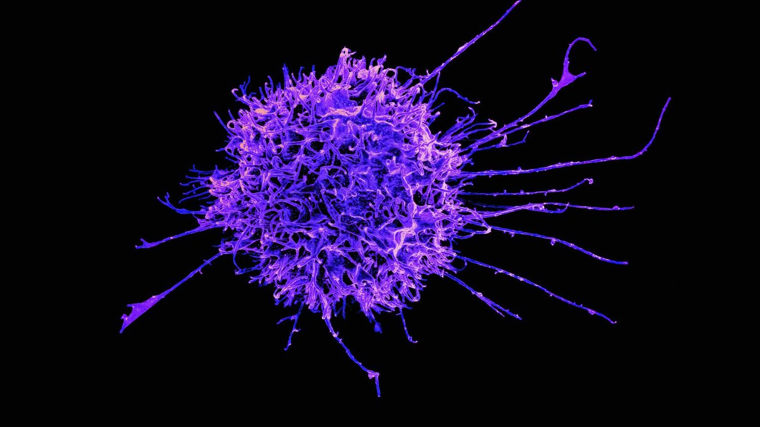 RNA's first letter may shape antiviral alarms, with A outpacing G