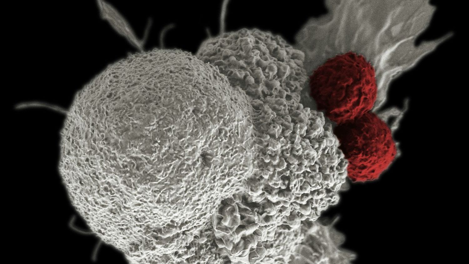 A revolutionary cancer treatment could transform autoimmune disease
