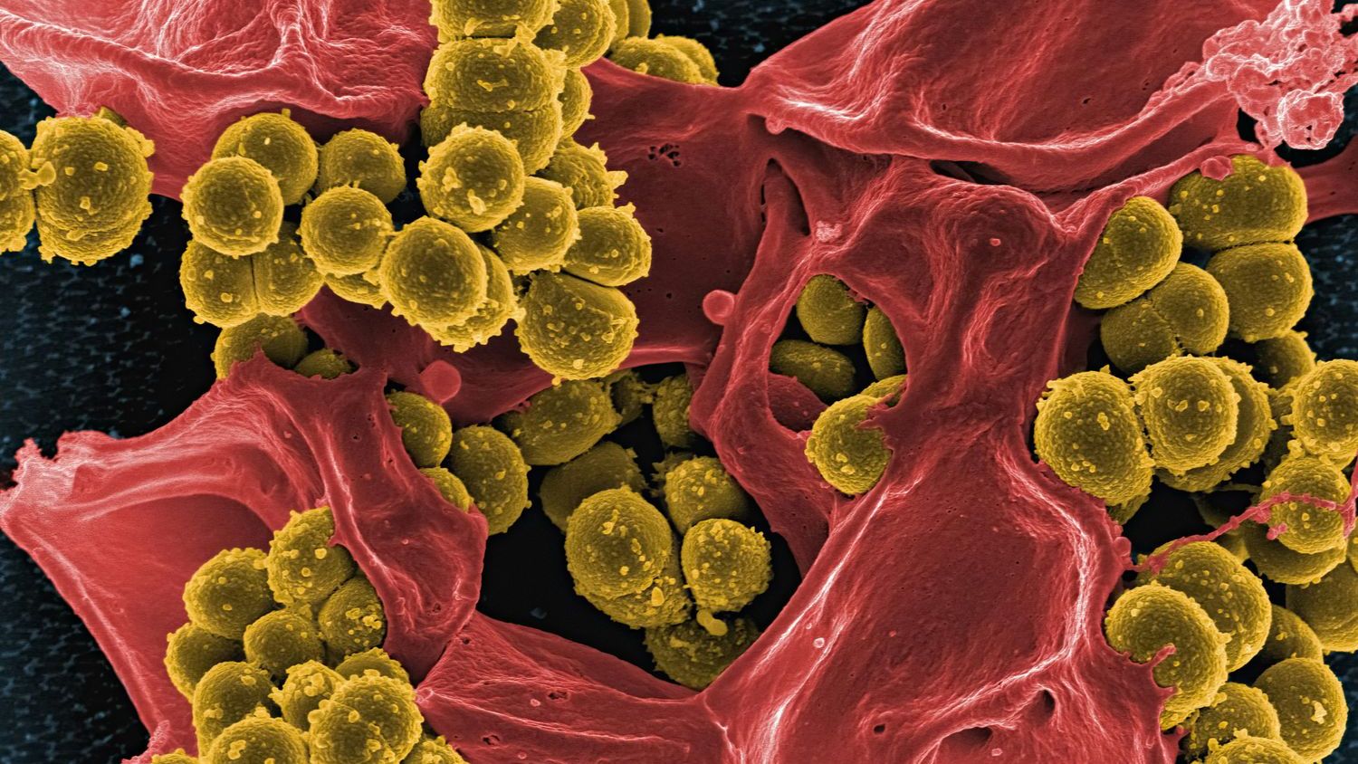 The bacteria living in and on your body outnumber your own cells, which means that by strict cellular count you are not majority human - and the ratio shifts noticeably depending on whether you’ve just been to the bathroom