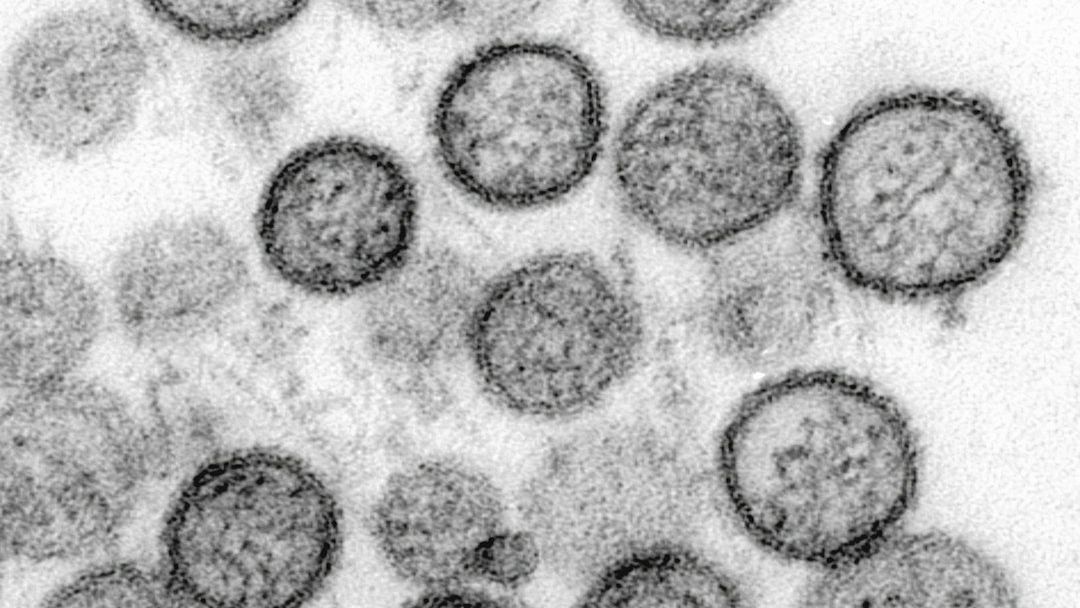 Canadian cruise ship passenger tests positive for hantavirus